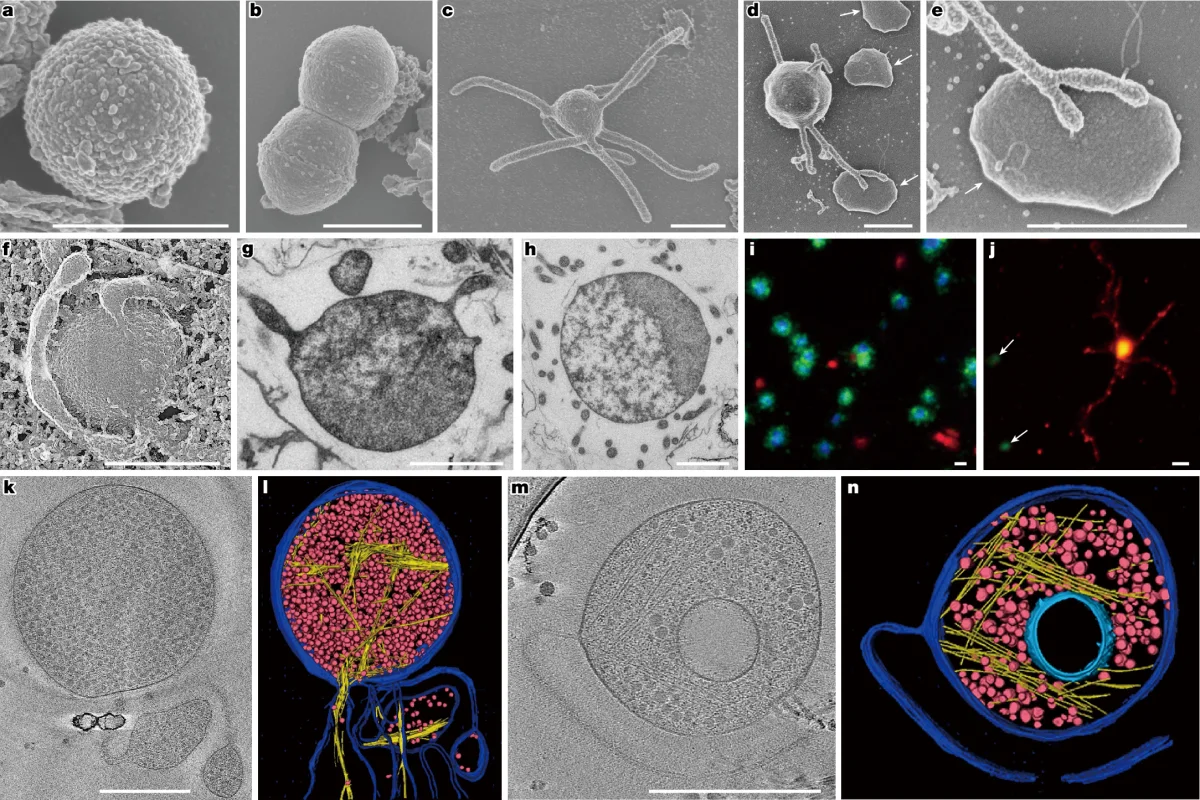Mikrograf sel Heimdallarchaeia memperlihatkan tonjolan membran pada permukaannya. Gambar diambil dari Fig. 2 publikasi penelitian di Nature.